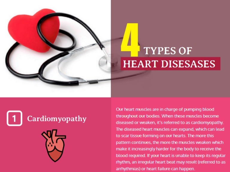 Four Most Common Types of Heart Diseases