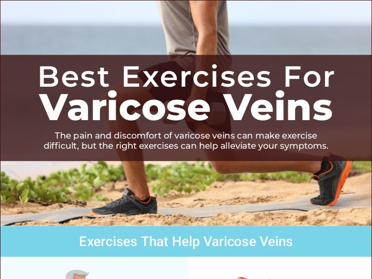 Best Exercises For Varicose Veins