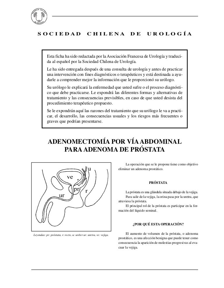 leuperona para el estrechamiento de la próstata leuperona para el estrechamiento de la próstata