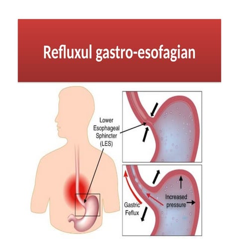 01 BRGE curs gastroenterologie facultatea medicina | PPTX