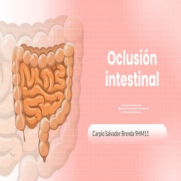 Oclusion intestinal, medicina, salud,..... | PPTX