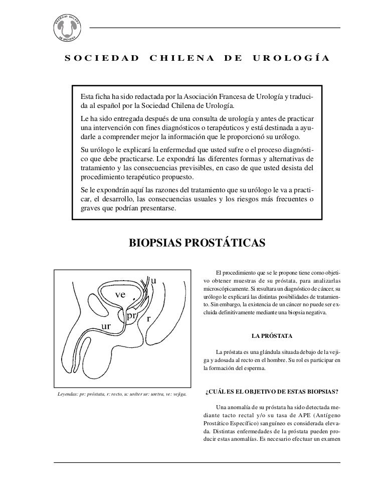 biopsia de prostata es necesaria