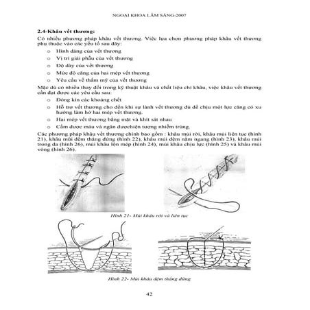Kỹ năng ngoại khoa (p2)