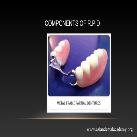 mejor connectors in removable partial dentures