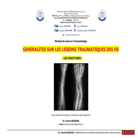 Généralités sur les fractures | PDF