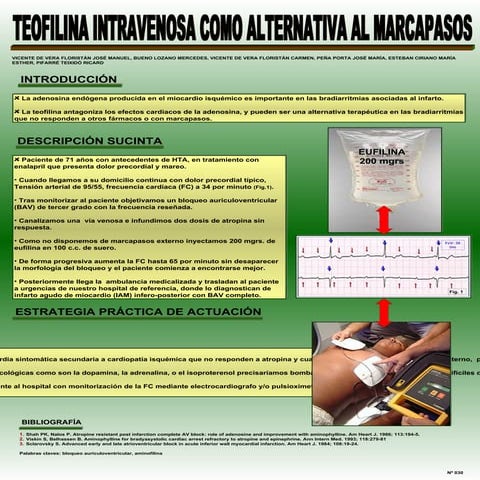 Presentación 030: TEOFILINA INTRAVENOSA COMO ALTERNATIVA AL MARCAPASOS ...