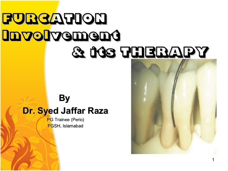 030.furcation involvement and its therapy