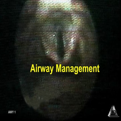 Airway management
