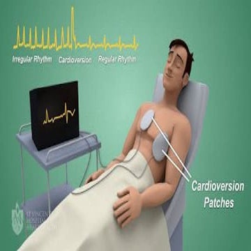 Heart Rhythm | PDF