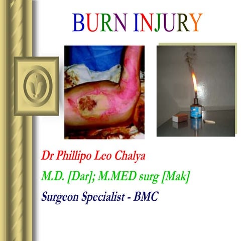 06.A BURN INJURY-DR PHILLIP BMC 1.ppt