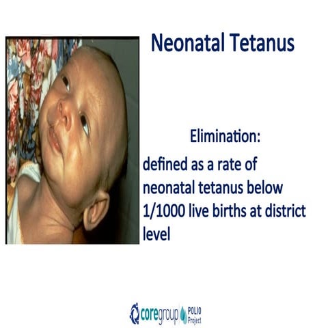 06 NNT Surveillance.ppt slides for health workers