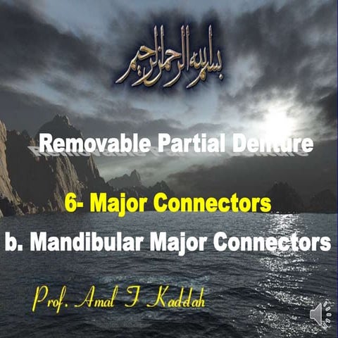 Mandibular major and minor connectors of RPDs