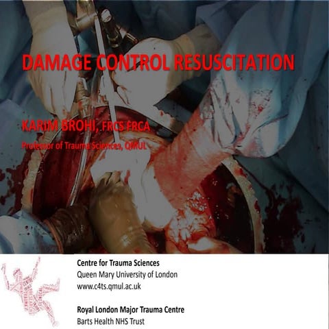 Damage Control in Trauma by Brohi