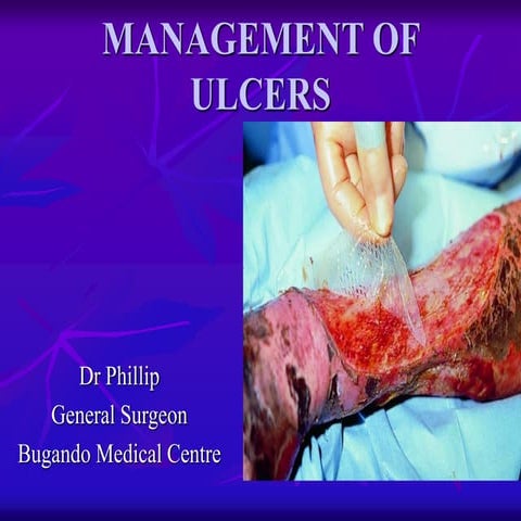 09. MANAGEMENT OF ULCERS-DR PHILLIP.ppt