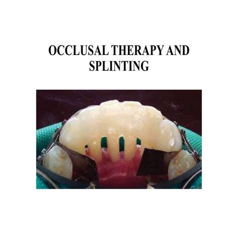 Dental splinting | PPTX