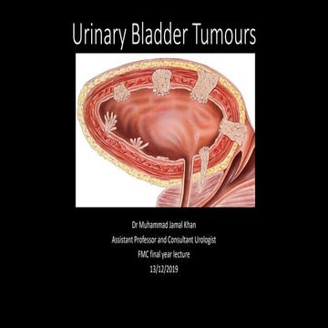 IMAGING OF CARCINOMA OF URINARY BLADDER | PPTX