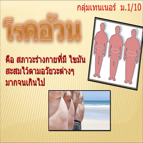โรคอ้วน กลุ่มเทรนเนอร์  ม.1/10 