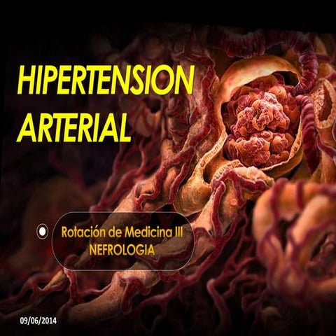 HYPERTENSION by Rudy Paucara