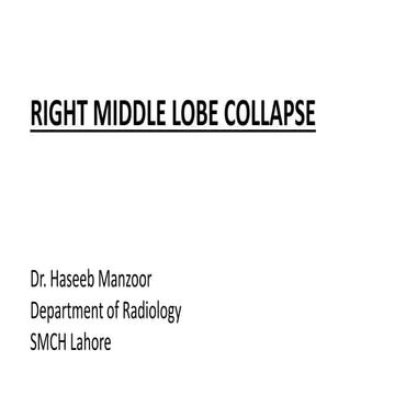 right middle lobe collapse