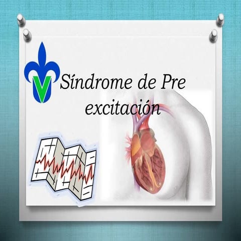  Sindrome de preexitacion