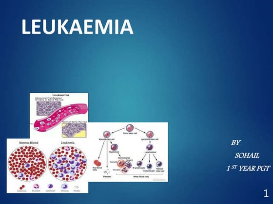 Oral manifestation of leukemia | PPT - Oral Stomatitis Leukemia Online Community