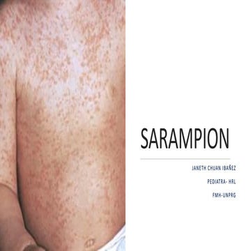 1. SARAMPION-PDF.pdf