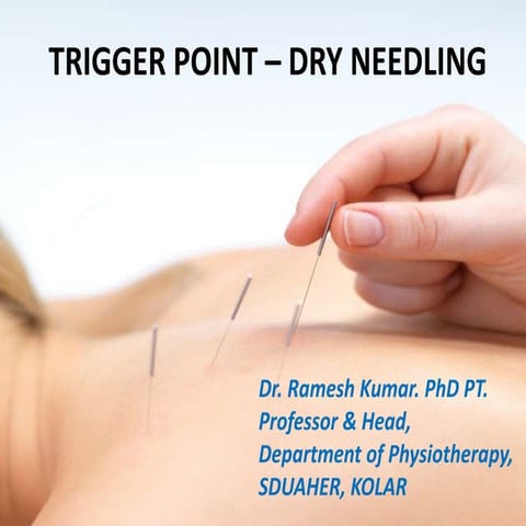 basics in dry needling and trigger points