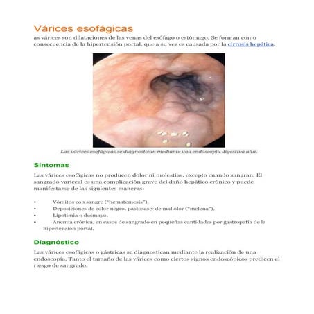 1.7 várices esofágicas