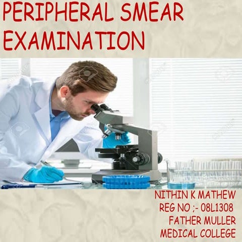 PERIPHERAL SMEAR EXAMINATION