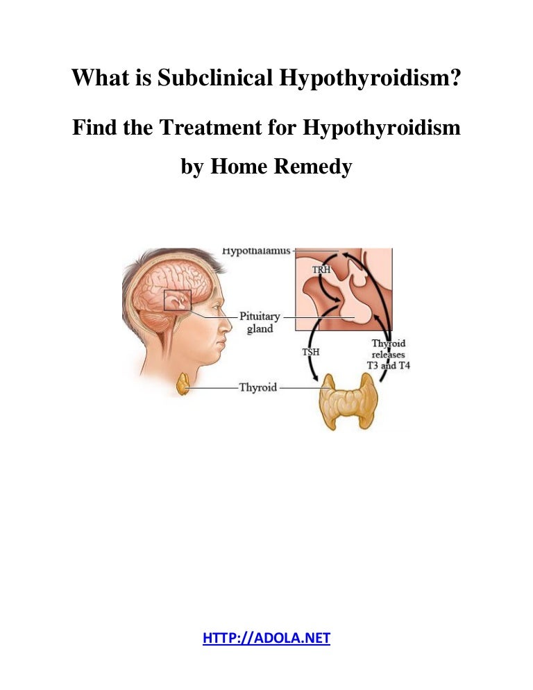 What Is Subclinical Hypothyroidism Find The Treatment For Hypothyroi 