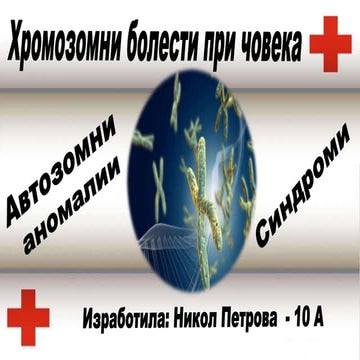 Хромозомни болести при човека–автозомни аномалии–синдроми–Никол Петрова ...