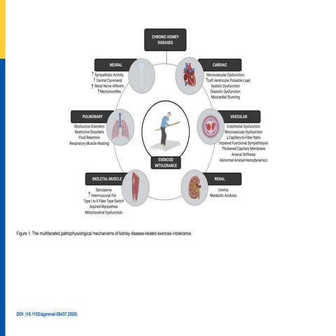 The multifaceted pathophysiological mechanisms of kidney disease ...