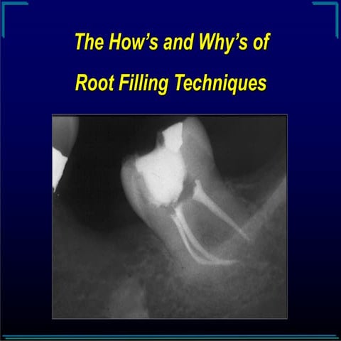 Root Canal Filling Materials (Dr Shreedhar Angadi).pptx
