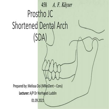 Shortened Dental Arch (SDA) Concept in Prosthodontics | PDF