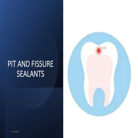PIT AND FISSURE SEALANTS