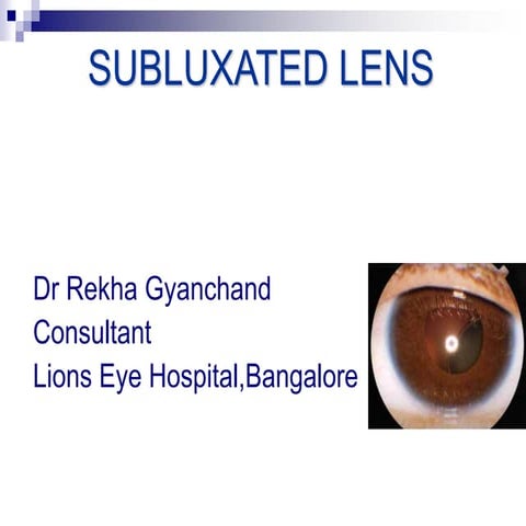 10-subluxated-lens.ppt