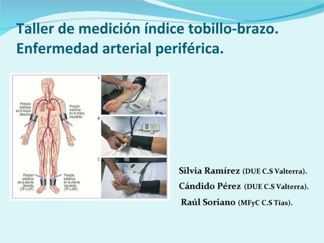 Taller Indice tobillo brazo