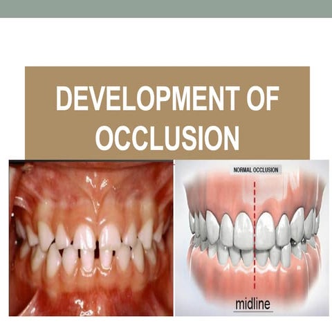 occlusion.pdf