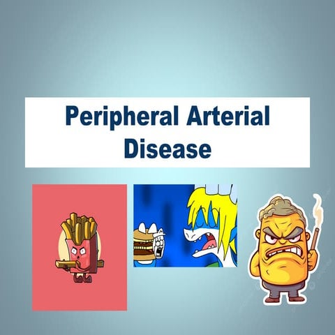 peripheral vascular disease | PPTX