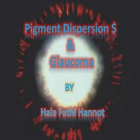pigment dispersion syndrome by Hala Fathi Hannot