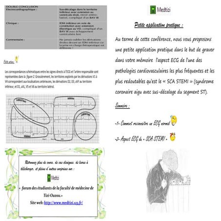 10critéres ecg normal officiel