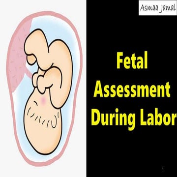 Fetal assessment