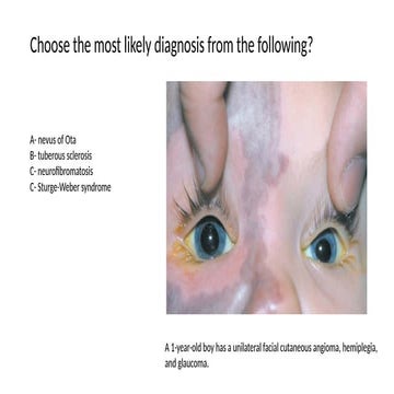 54 Multiple Choice Questions (MCQS) - glaucoma.docx