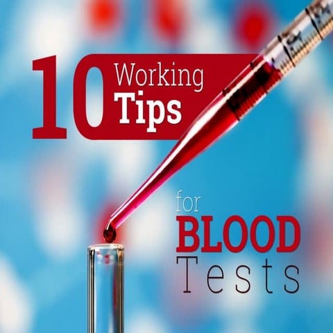 10 Working Tips for Blood Test