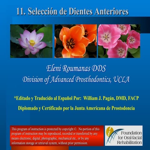 11. seleccion de dientes anteriores