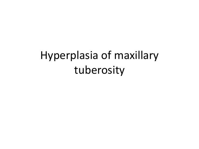 11.hyperplasia of maxillary tuberosity