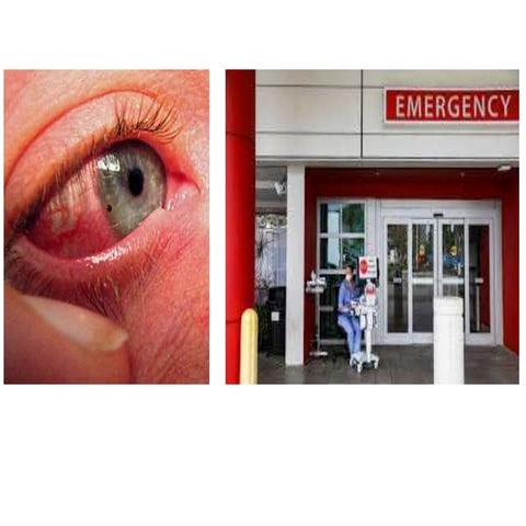 11. ocular emergencies and their prevention