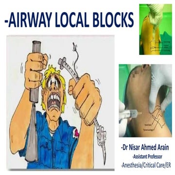 airway local blocks-Anesthesia