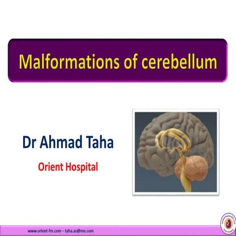 Malformations of Cerebellum