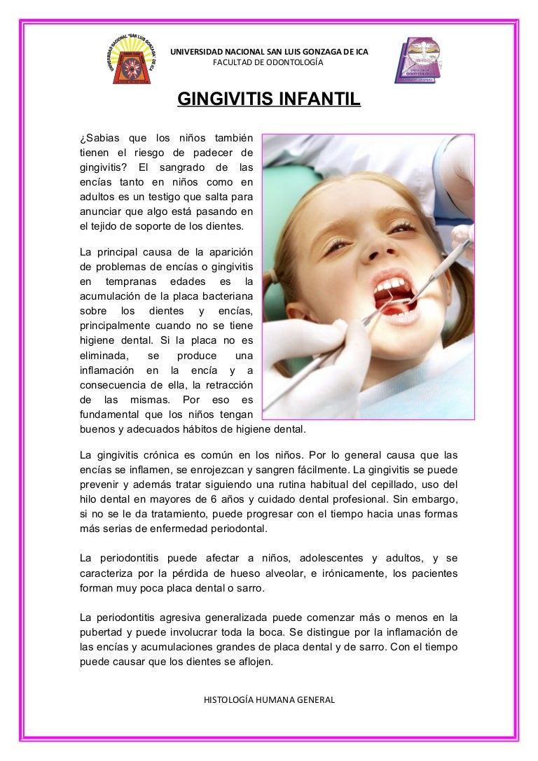 gingivitis en niños de 6 a 12 años